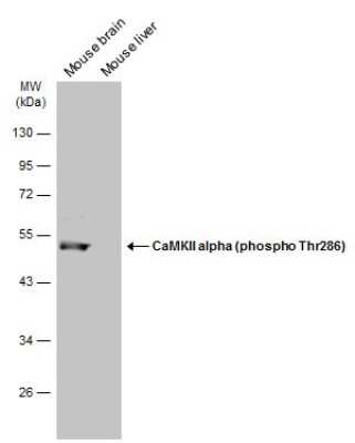 Western Blot: CaM Kinase II alpha [p Thr286] Antibody [NBP3-13299] - Various tissue extracts (30 ug) were separated by 10% SDS-PAGE, and the membrane was blotted with CaM Kinase II alpha (phospho Thr286) antibody (NBP3-13299) diluted at 1:500. The HRP-conjugated anti-rabbit IgG antibody (NBP2-19301) was used to detect the primary antibody.